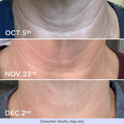 Neck firming Cream