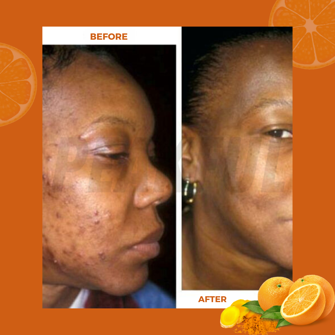 BrightBar™ -Soap To Help Reduce Darkspots