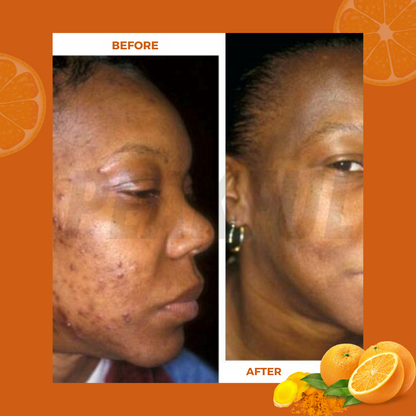 BrightBar™ -Soap To Help Reduce Darkspots